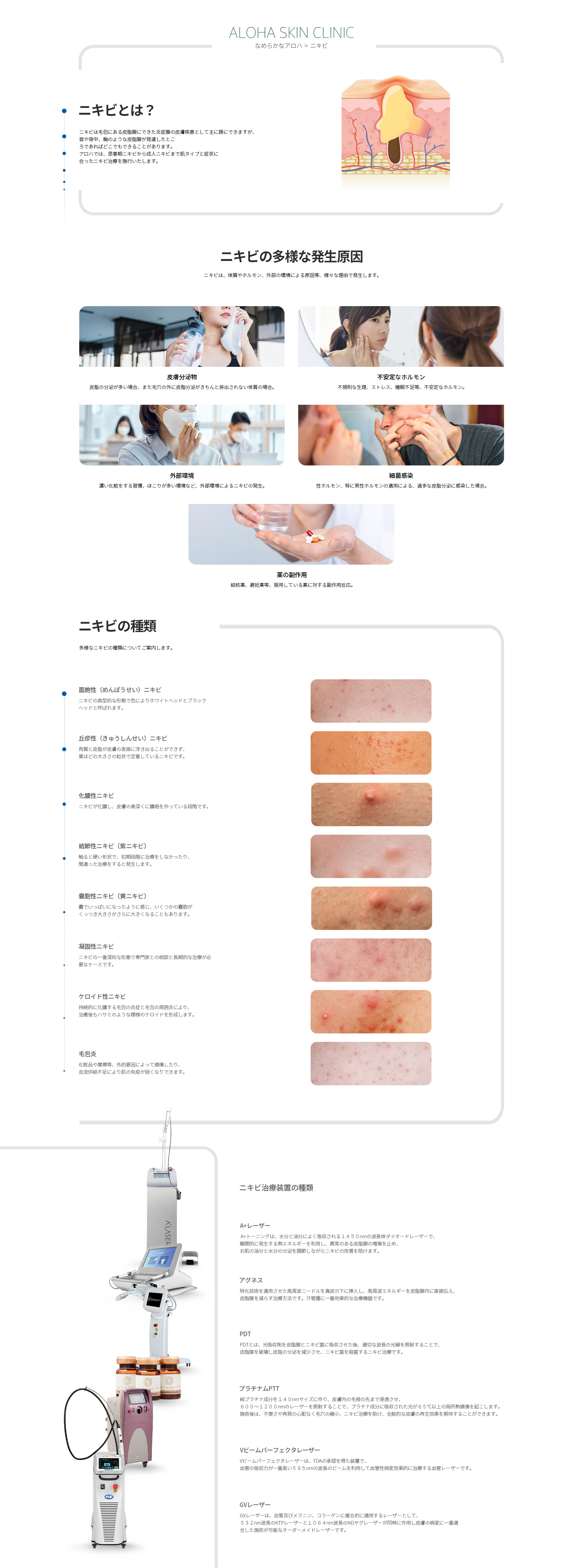 ニキビ