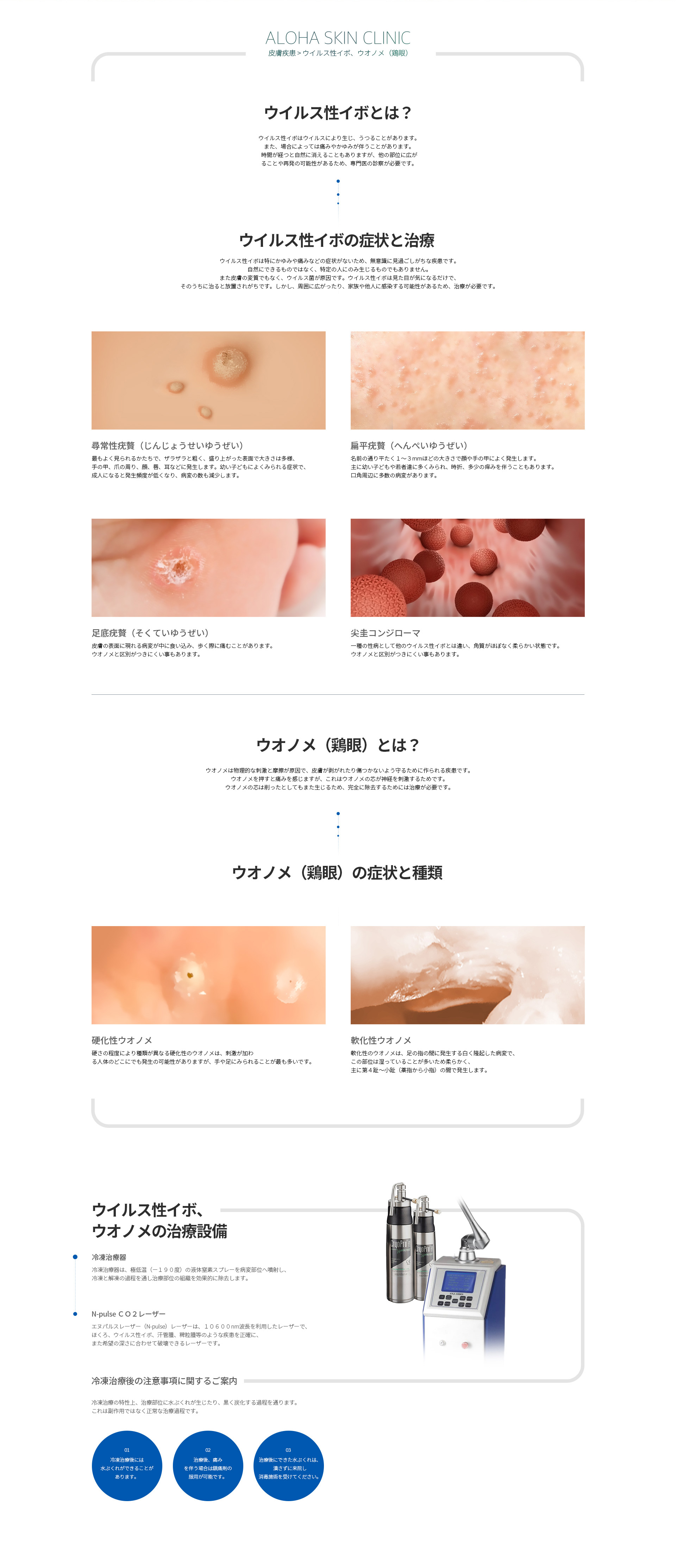 ウイルス性イボ、<br>ウオノメ（鶏眼）