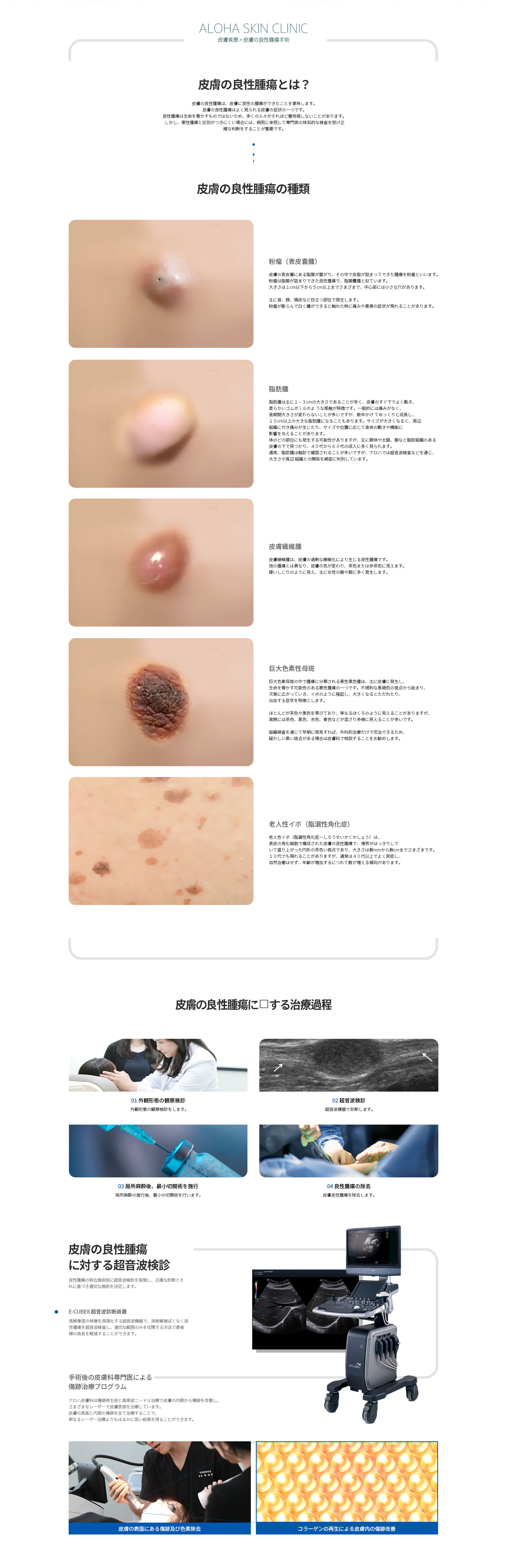 皮膚の良性腫瘍手術