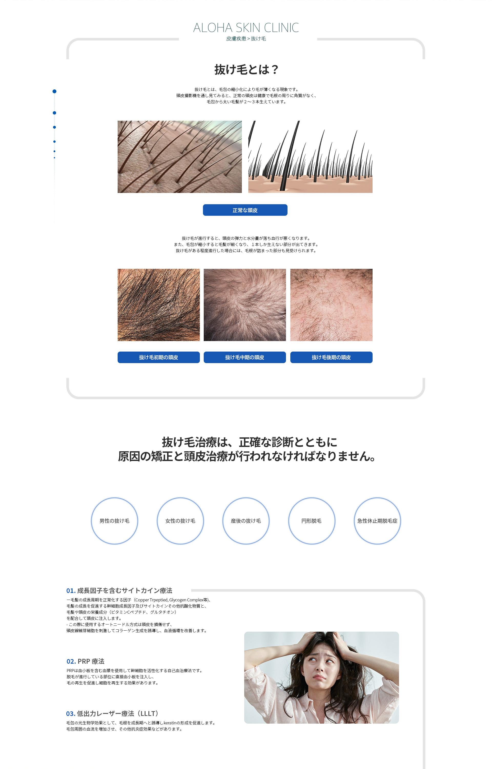 抜け毛